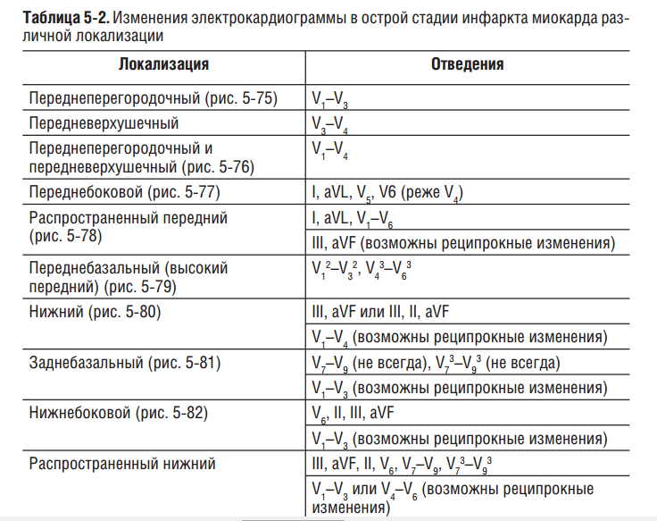 Таблица экг